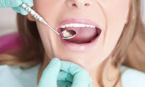 5 Ways to Take Care of Your Teeth